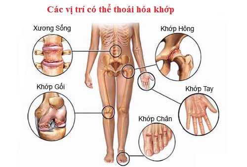 Phòng ngừa thoái hóa khớp đơn giản và hiệu quả