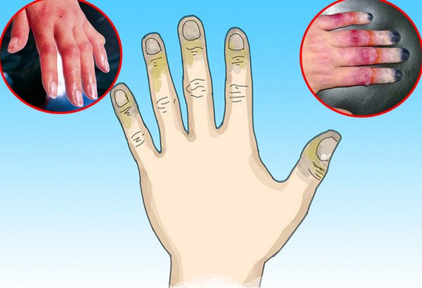 Tìm hiểu về các loại thuốc sát trùng ngoài da hiệu quả