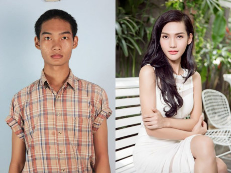 Phẫu thuật chuyển giới không còn xa lạ trong xã hội Phẫu thuật chuyển giới không còn xa lạ trong xã hội