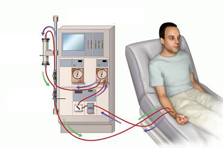 Quy trình chạy thận nhân tạo như thế nào? Quy trình chạy thận nhân tạo như thế nào?