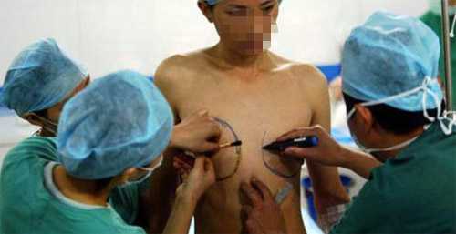 Quy trình chuyển giới từ nam sang nữ cho phép bệnh nhân sống thật với giới tính của mình Quy trình chuyển giới từ nam sang nữ cho phép bệnh nhân sống thật với giới tính của mình
